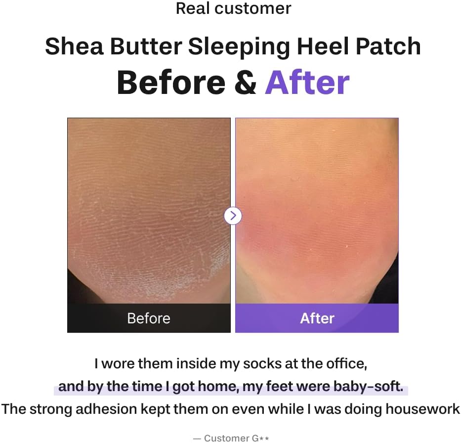 Baren Shea Butter Heel Patch, Overnight Cracked Heel Foot Mask