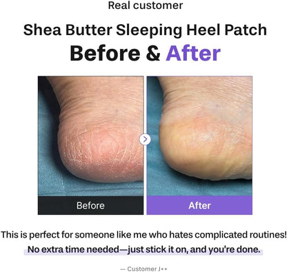 Baren Shea Butter Heel Patch, Overnight Cracked Heel Foot Mask
